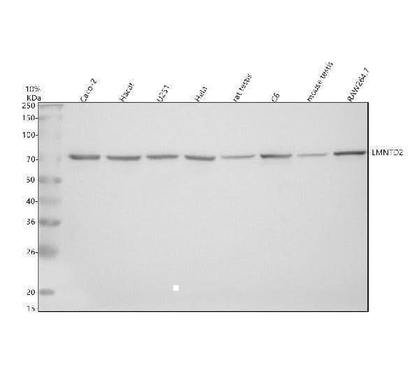 Anti-LMNTD2 Antibody Picoband® Boster Bio