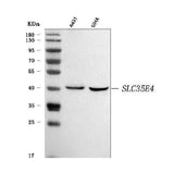 Anti-SLC35E4 Antibody Picoband® Boster Bio