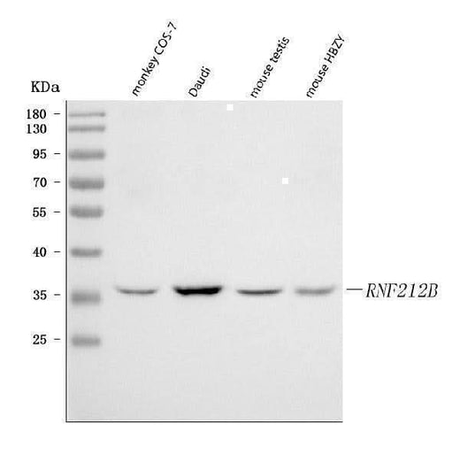 Anti-RNF212B Antibody Picoband® Boster Bio