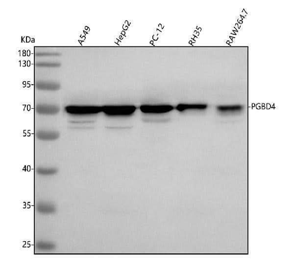 Anti-PGBD4 Antibody Picoband® Boster Bio