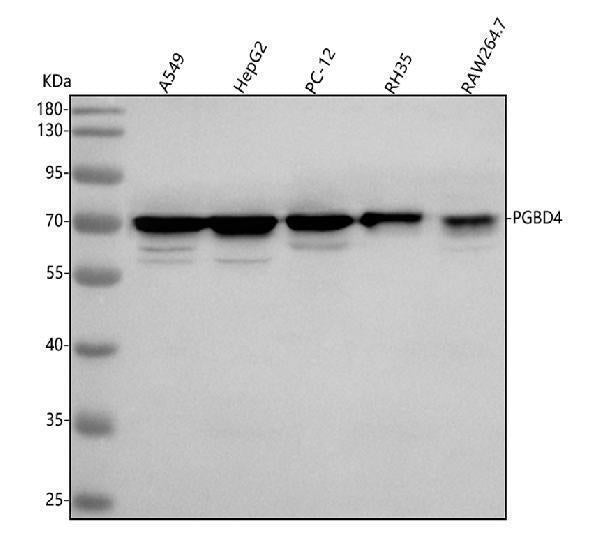 Anti-PGBD4 Antibody Picoband® Boster Bio