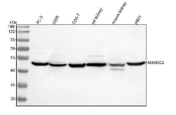 Anti-MANSC4 Antibody Picoband® Boster Bio