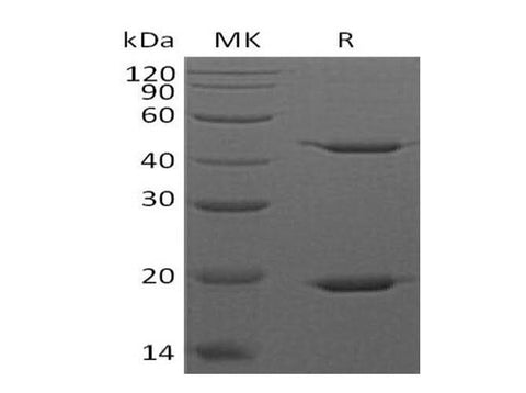 Recombinant Human STAT3 Protein (His Tag) - ABMIUM