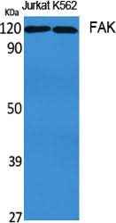 Anti-Human/Mouse/Rat FAK Antibody