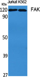 Western Blot analysis of Jurkat, K562 cells using FAK Polyclonal Antibody at dilution of 1:1000.