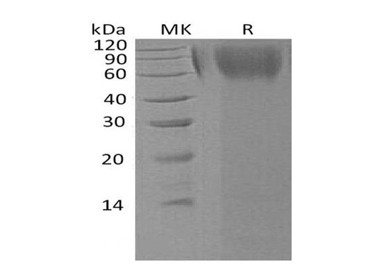 Recombinant Human LAMP1/CD107a Protein (His Tag) - ABMIUM