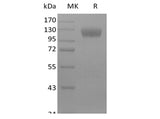 Recombinant Mouse Siglec-10 (C-Fc) - ABMIUM