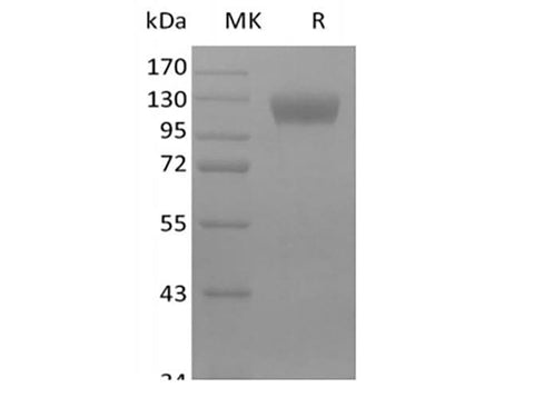 Recombinant Mouse Siglec-10 (C-Fc) - ABMIUM