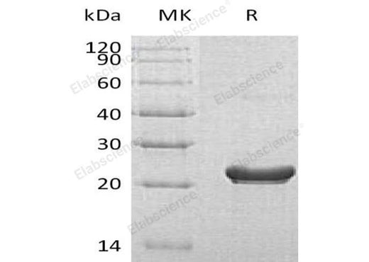 Recombinant Human RPS7 Protein (His Tag) - ABMIUM