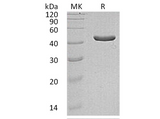 Recombinant Human IDH1 Protein (Human Cells, His Tag) - ABMIUM