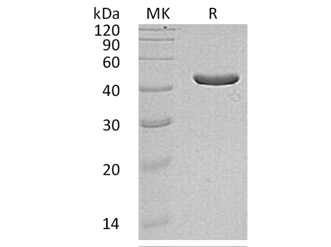Recombinant Human IDH1 Protein (Human Cells, His Tag) - ABMIUM