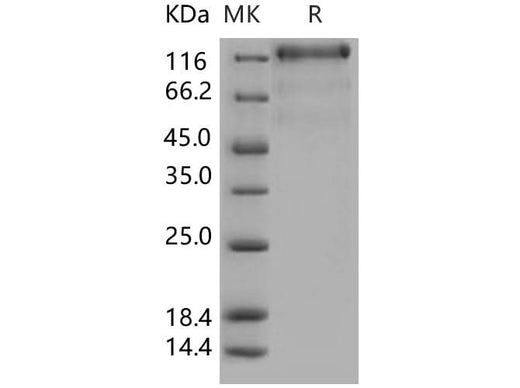 Recombinant Human VEGFR3/FLT4 Protein (His Tag) - ABMIUM