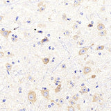 Immunohistochemistry analysis of paraffin-embedded mouse spinal marrow using NTRK2 Polyclonal Antibody at dilution of 1:400.
