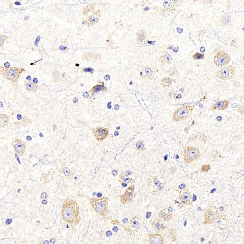 Immunohistochemistry analysis of paraffin-embedded mouse spinal marrow using NTRK2 Polyclonal Antibody at dilution of 1:400.