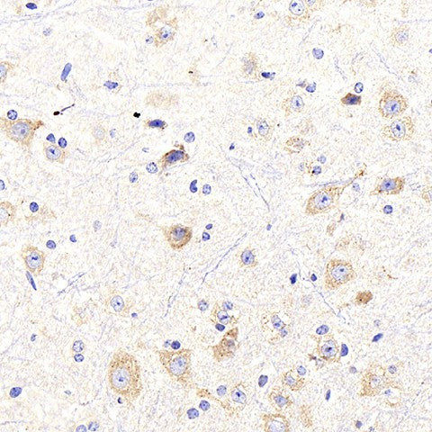Immunohistochemistry analysis of paraffin-embedded mouse spinal marrow using NTRK2 Polyclonal Antibody at dilution of 1:400.