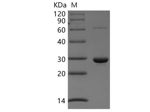 Recombinant Human Peroxiredoxin-4/PRDX4 Protein (His Tag) - ABMIUM