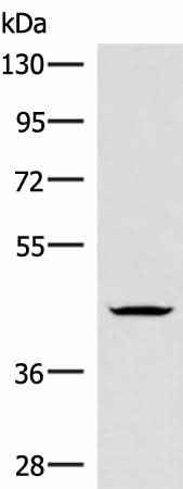 Western blot analysis of Jurkat cell lysate using HMBOX1 Polyclonal Antibody at dilution of 1:300