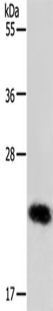 Anti-Human/Mouse RAB22A Antibody - ABMIUM