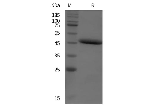 SDS-PAGE analysis of Mouse Alpl proteins, 2 μg/lane of Recombinant Mouse Alpl proteins was resolved with SDS-PAGE under reducing conditions, showing bands at 48 kDa.
