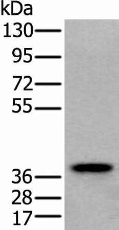 Anti-Human/Mouse ZPBP Antibody