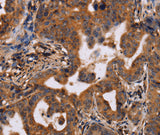 Anti-Human IL12RB2 Antibody - ABMIUM