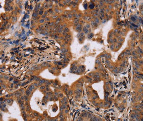 Anti-Human IL12RB2 Antibody - ABMIUM