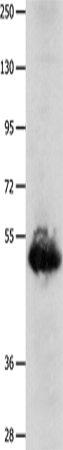 Anti-Human BPIFB3 Antibody - ABMIUM