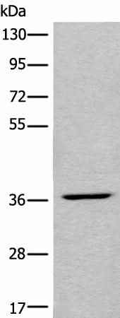 Anti-Human LDAH Antibody