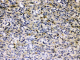 Anti-Hepatitis B Virus Antibody Picoband® Boster Bio