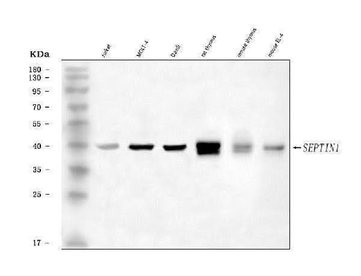 Anti-LARP/SEPTIN1 Antibody Picoband® Boster Bio