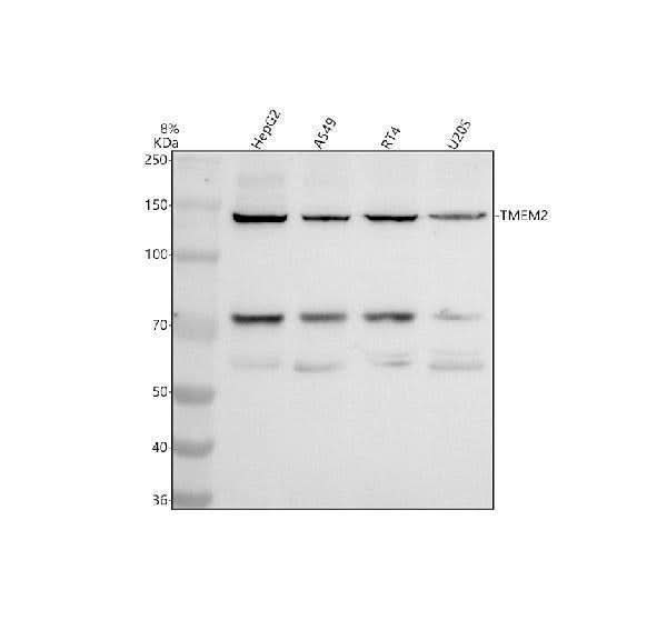 Anti-CEMIP2 Antibody Picoband® Boster Bio