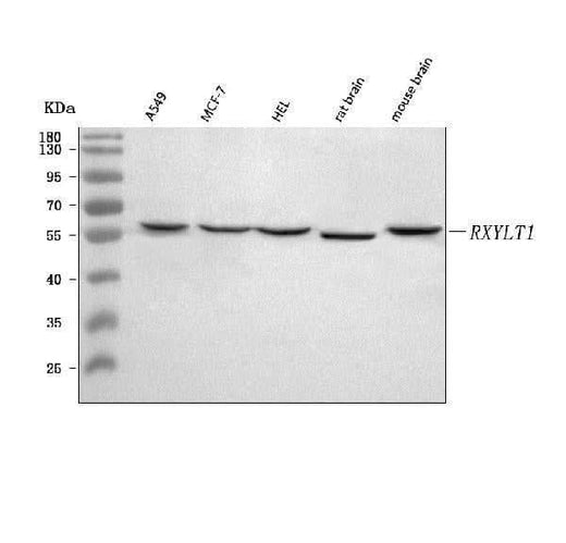 Anti-TMEM5/RXYLT1 Antibody Picoband® Boster Bio