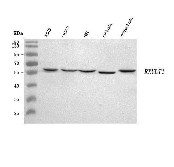 Anti-TMEM5/RXYLT1 Antibody Picoband® Boster Bio