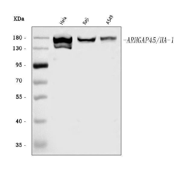 Anti-ARHGAP45 Antibody Picoband® Boster Bio