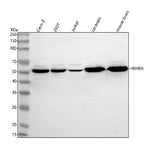 Anti-HDHD5 Antibody Picoband® Boster Bio