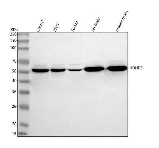 Anti-HDHD5 Antibody Picoband® Boster Bio