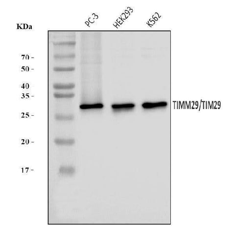 Anti-TIMM29 Antibody Picoband® Boster Bio