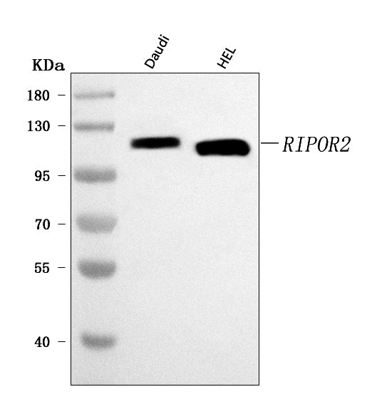 Anti-FAM65B/RIPOR2 Antibody Picoband® Boster Bio