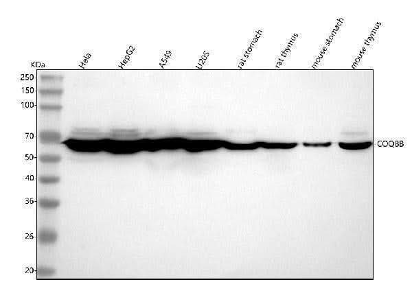 Anti-COQ8B Antibody Picoband® Boster Bio