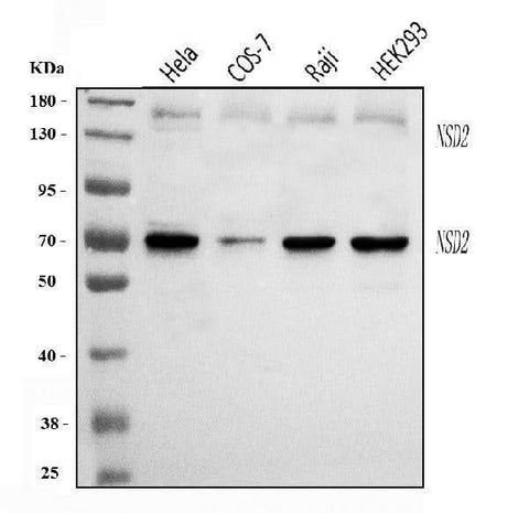 Anti-WHSC1/NSD2 Antibody Picoband® Boster Bio