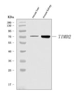 Anti-Tim 2/Timd2 Antibody Picoband® Boster Bio