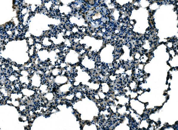 Anti-Ccl21a Antibody Boster Bio