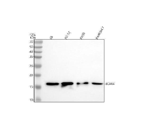 Anti-BCAR4 Antibody Picoband® Boster Bio