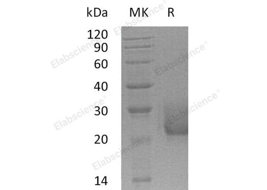 Recombinant Human CEACAM7/CGM2 Protein (His Tag) - ABMIUM