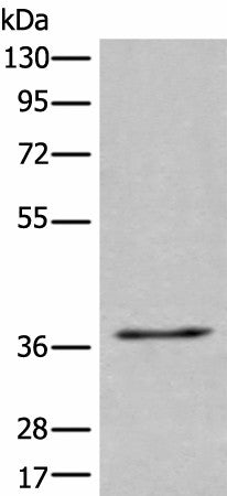 Western blot analysis of 231 cell lysate using UBAC2 Polyclonal Antibody at dilution of 1:400