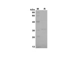 SDS-PAGE analysis of Rat CCL20/MIP-3α proteins, 2 μg/lane of Recombinant Rat CCL20/MIP-3α proteins was resolved with SDS-PAGE under reducing conditions, showing bands at 31 kDa.