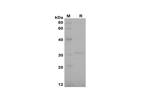 SDS-PAGE analysis of Rat CCL20/MIP-3α proteins, 2 μg/lane of Recombinant Rat CCL20/MIP-3α proteins was resolved with SDS-PAGE under reducing conditions, showing bands at 31 kDa.