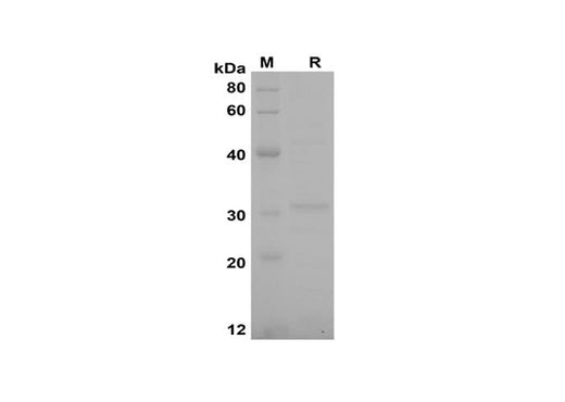 SDS-PAGE analysis of Rat CCL20/MIP-3α proteins, 2 μg/lane of Recombinant Rat CCL20/MIP-3α proteins was resolved with SDS-PAGE under reducing conditions, showing bands at 31 kDa.