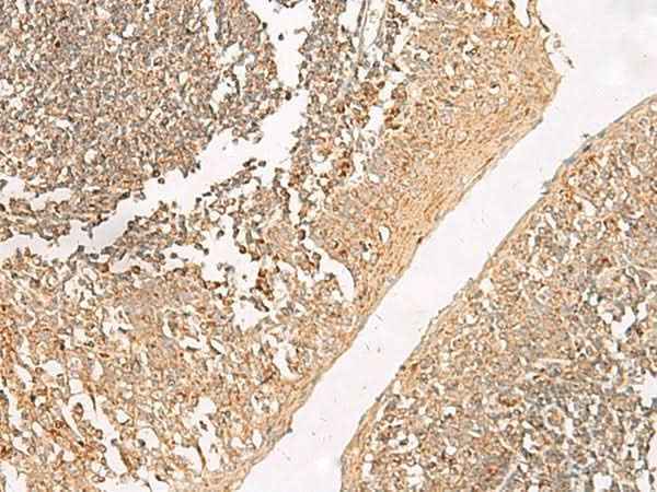 Anti-Human/Mouse/Rat GRIK5 Antibody
