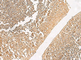 Immunohistochemistry of paraffin-embedded Human tonsil tissue using GRIK5 Polyclonal Antibody at dilution of 1:35(×200)